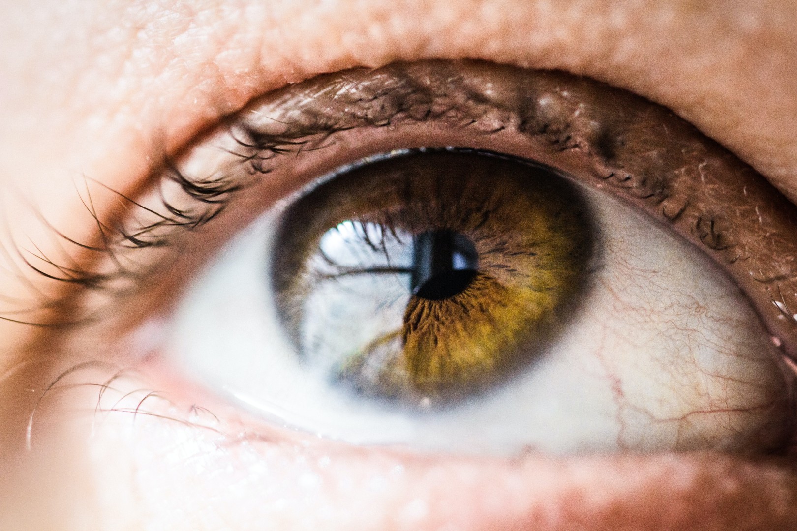 Normales Auge, keine roten Augen